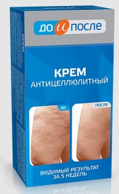 Купить до и после антицеллюлитный крем, 100мл в Нижнем Новгороде